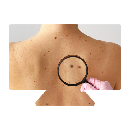 capsule d'expert dermato